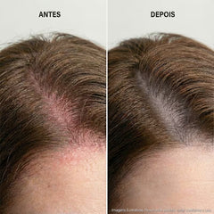 Keune Scalp Sensitive - Condicionador 250ml